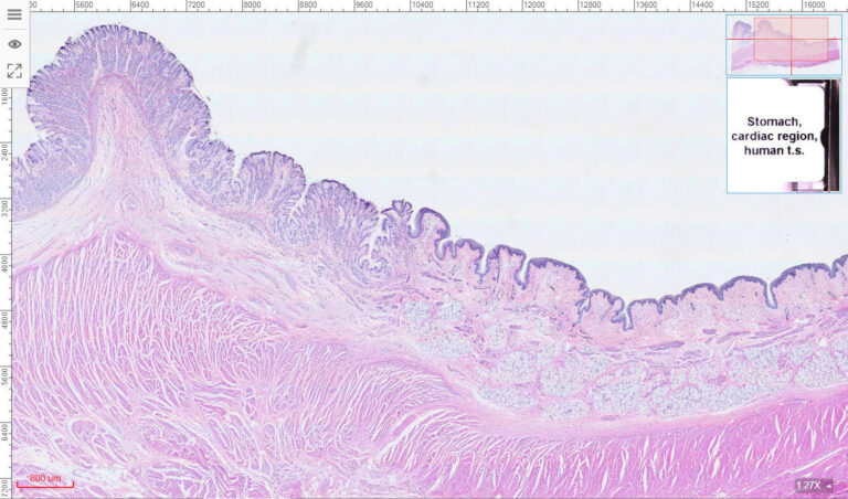 1pcs Human Cardia of stomach section H.E. stain, esophagus and stomach ...