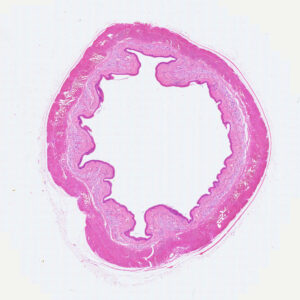 Human Esophagus cross-section