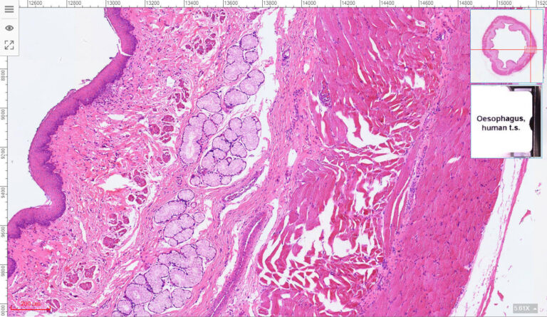 1pcs Human Esophagus Cross section H E Stain 1pcs-human-esophagus-cross-section-h-e-stain