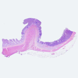 Human stomach pylorus