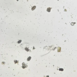 Ancylostoma duodenale ova