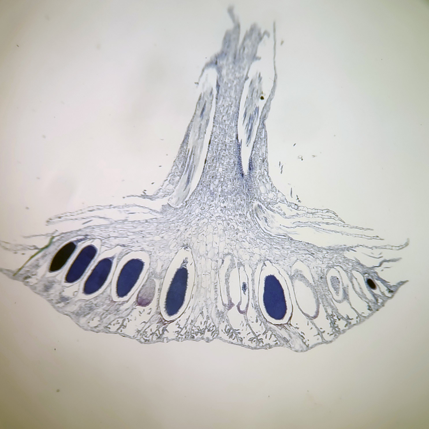 Moss Antheridium Longitudinal Section