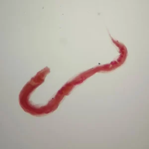 Enterobius vermicularis Adult Male
