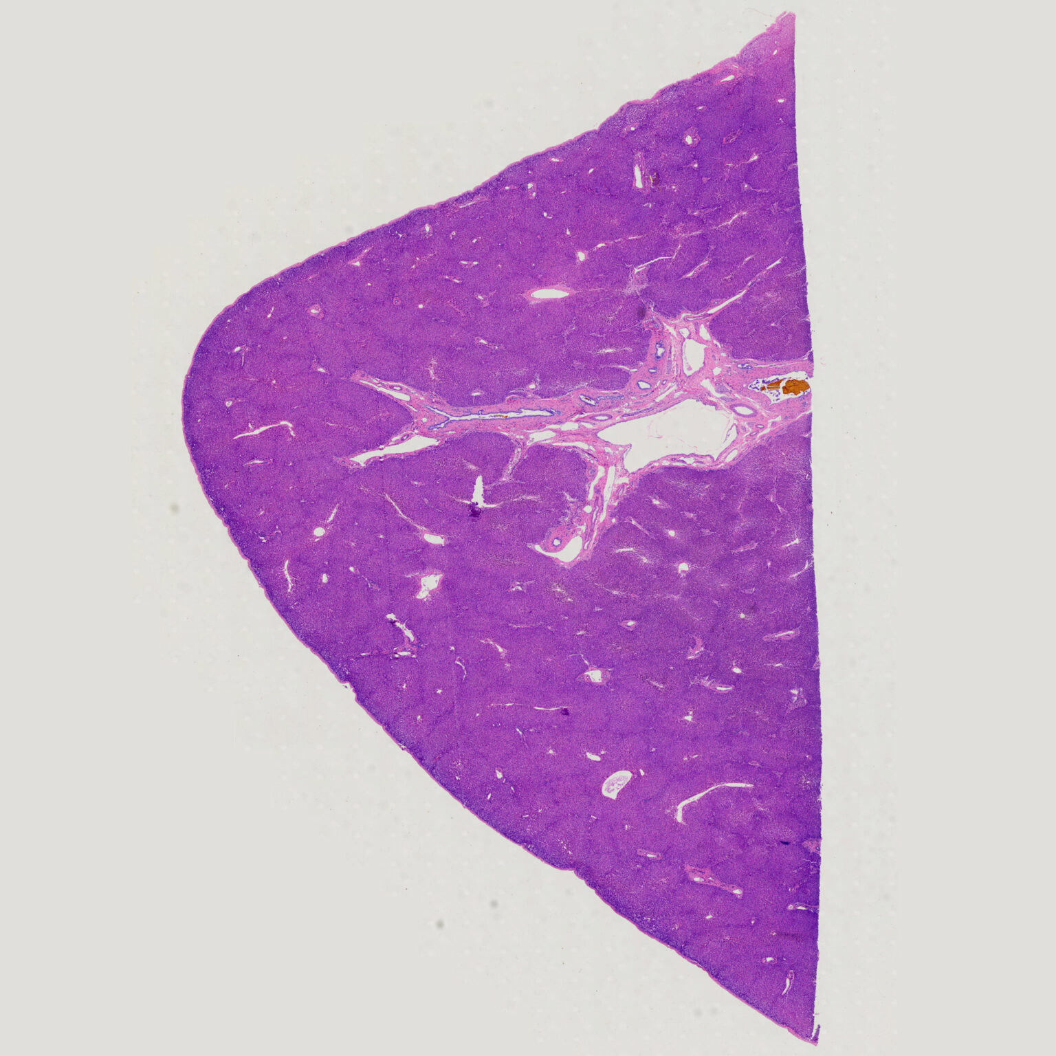 1pcs Human liver, 7 µm sec., H.E. stain