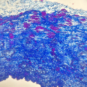 Artery Masson's trichrome stain