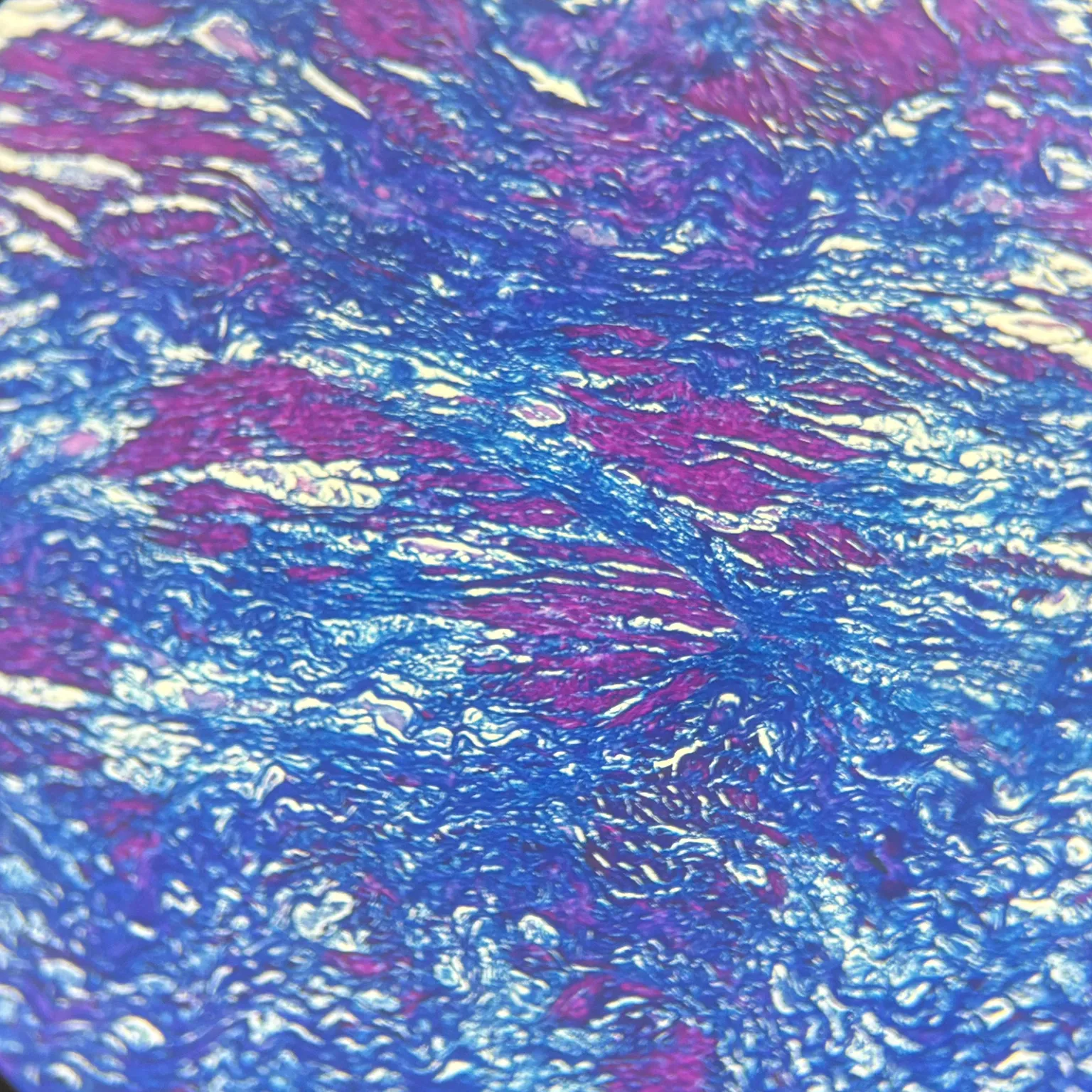 Artery-massons-trichrome