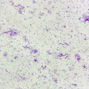 Bacteria Three Types slide (Cocci, Bacilli, Spirilla) Smear, Microbiology Prepared Slide