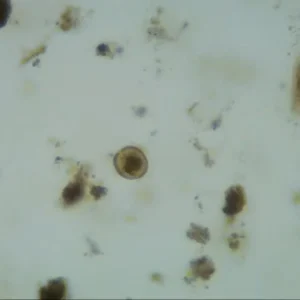Balantidium coli Cyst, Prepared Microscope Slides