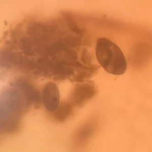 Balantidium coli Trophozoite, Prepared Microscope Slides