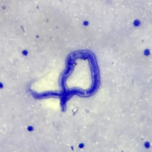 Brugia malayi Microfilaria Smear