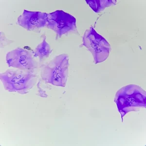 Chironomus Salivary Gland Polytene Chromosomes