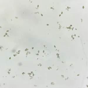Clonorchis sinensis Ova whole mount, natural color, Parasitology Slides