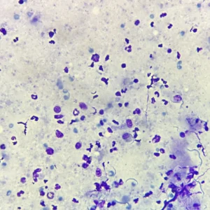 Cryptosporidium parvum Oocyst, Acid-Fast Stained, Prepared Microscope Slides