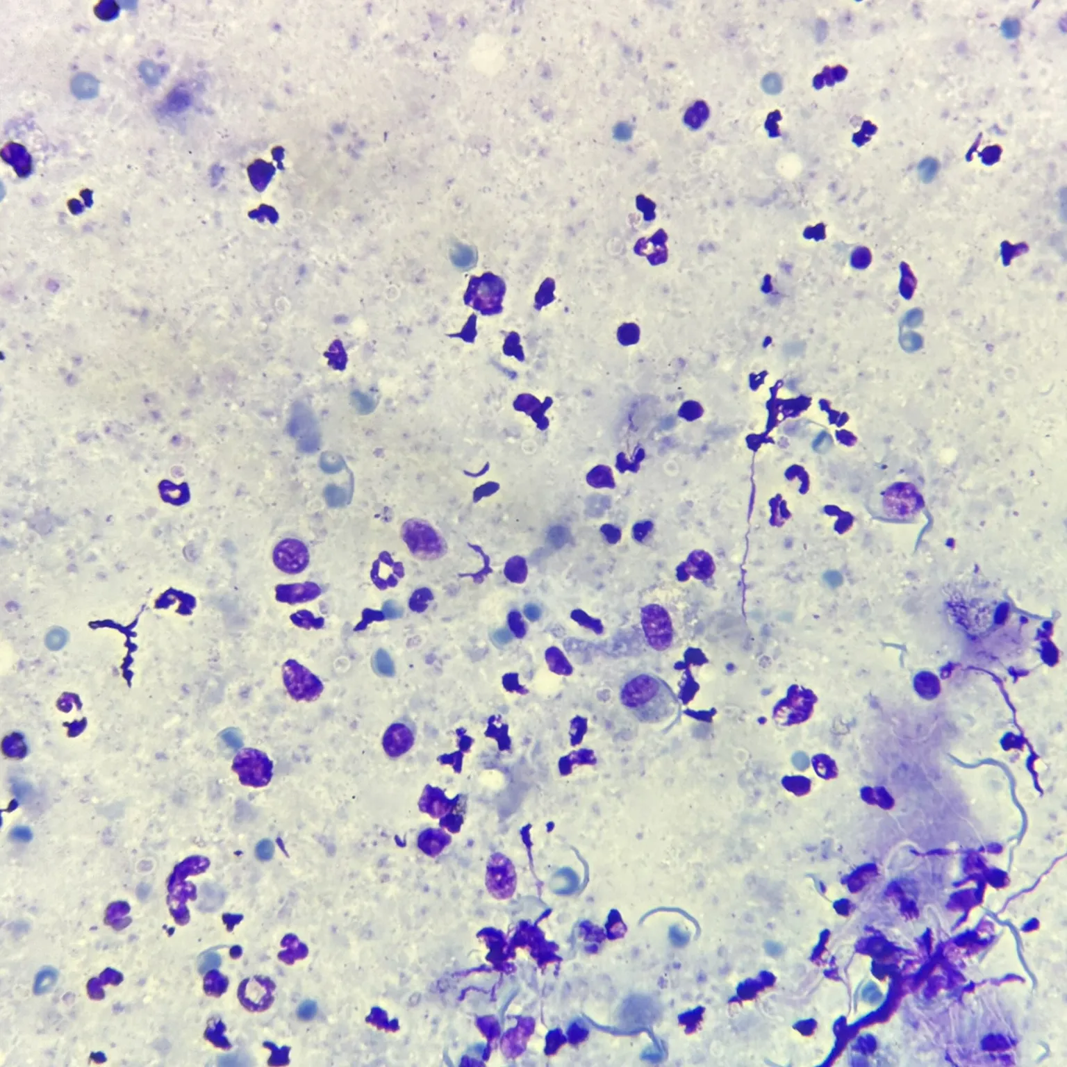 Cryptosporidium parvum Oocyst, Acid-Fast Stained, Prepared Microscope Slides