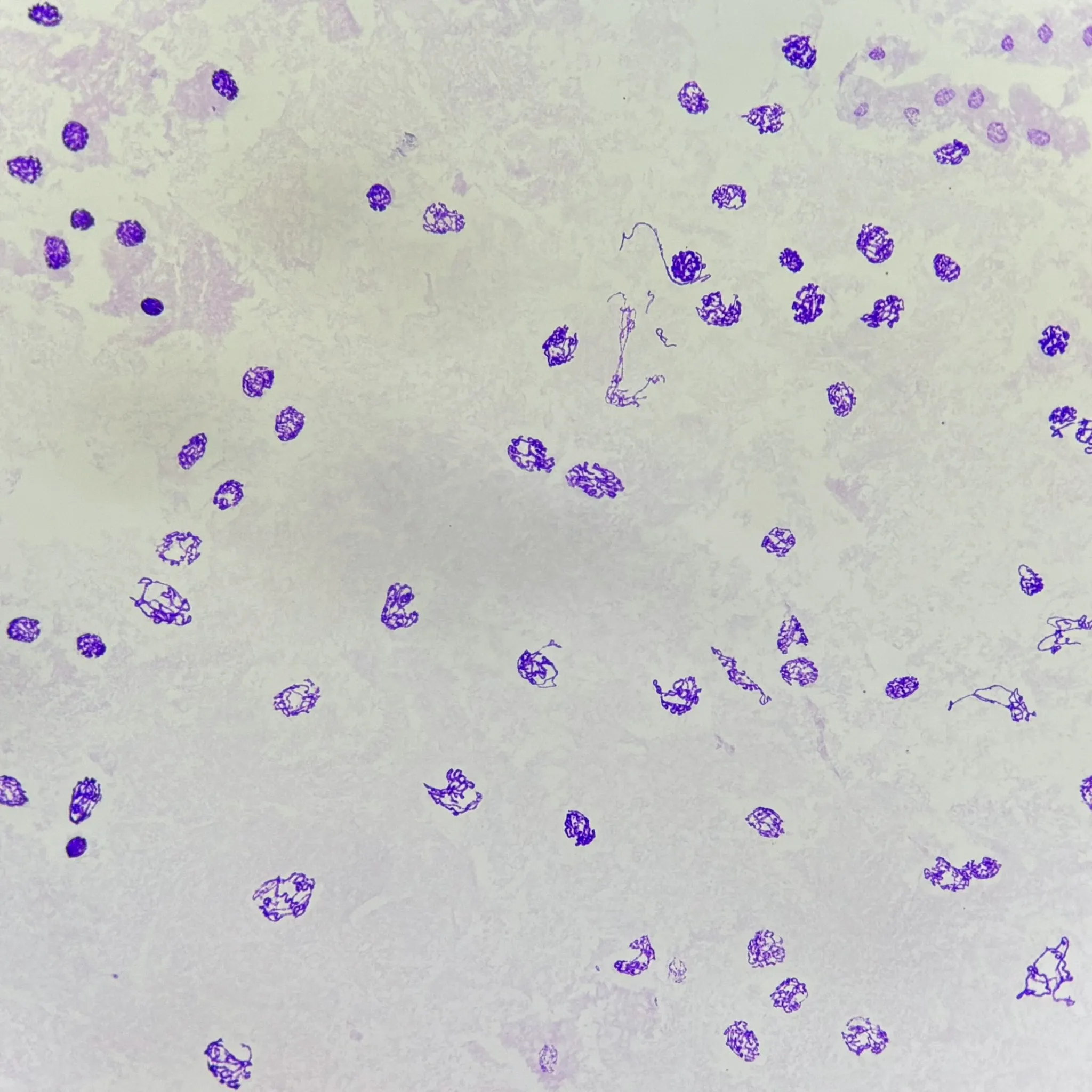 Drosophila Salivary Gland Polytene Chromosomes