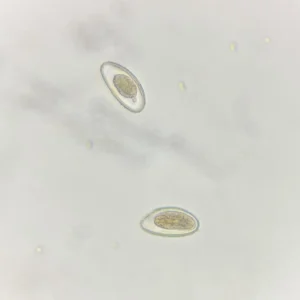 Enterobius vermicularis Ova