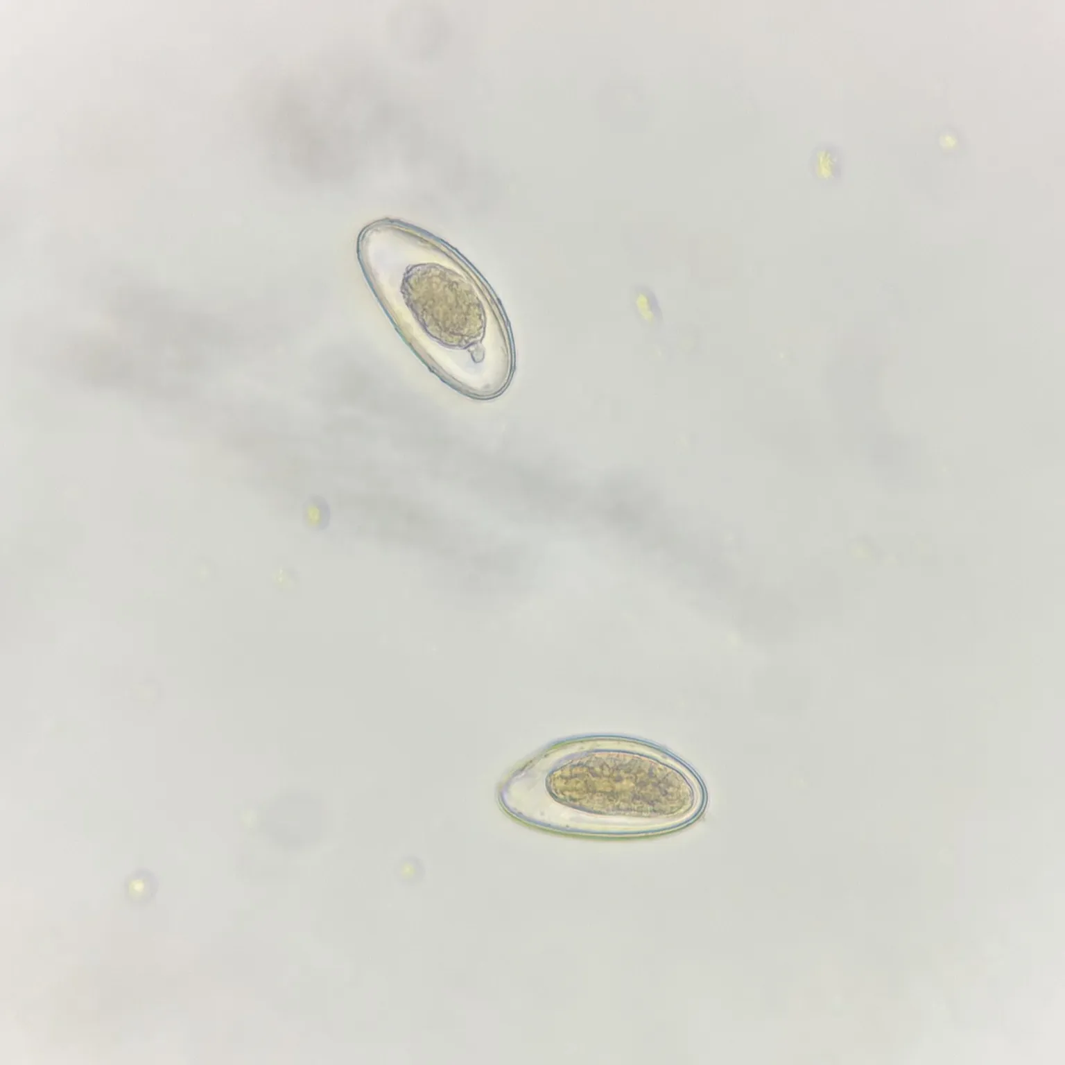 Enterobius vermicularis Ova