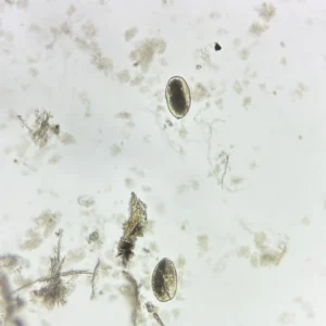 Fasciola hepatica Ova whole mount, natural color, Parasitology Slides