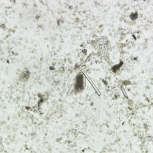 Fasciolopsis buski Ova whole mount, natural color, Parasitology Slides