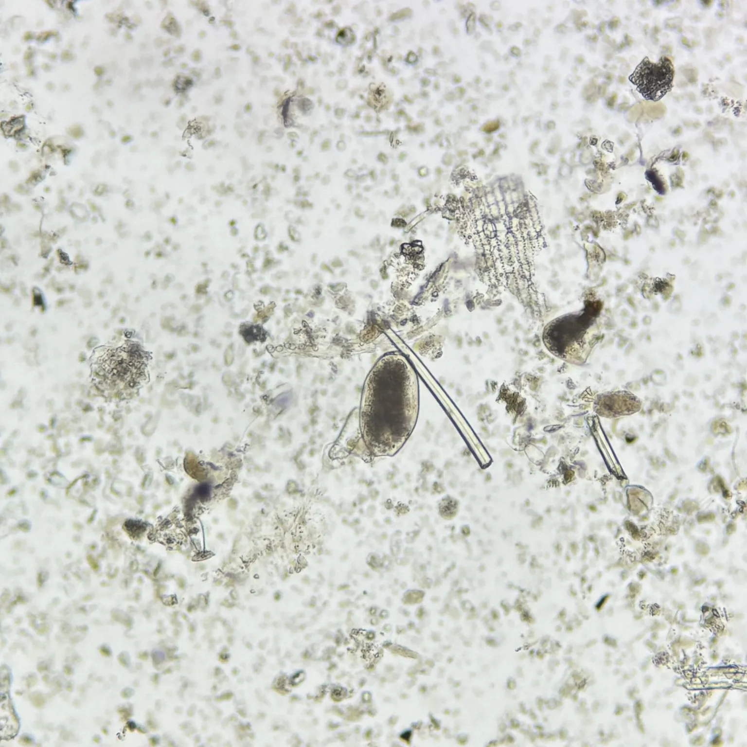 Fasciolopsis buski Ova whole mount, natural color, Parasitology Slides