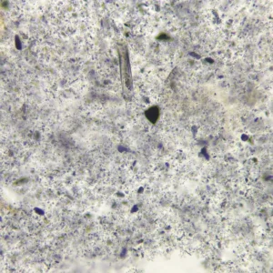 Giardia lamblia Cyst, Prepared Microscope Slides
