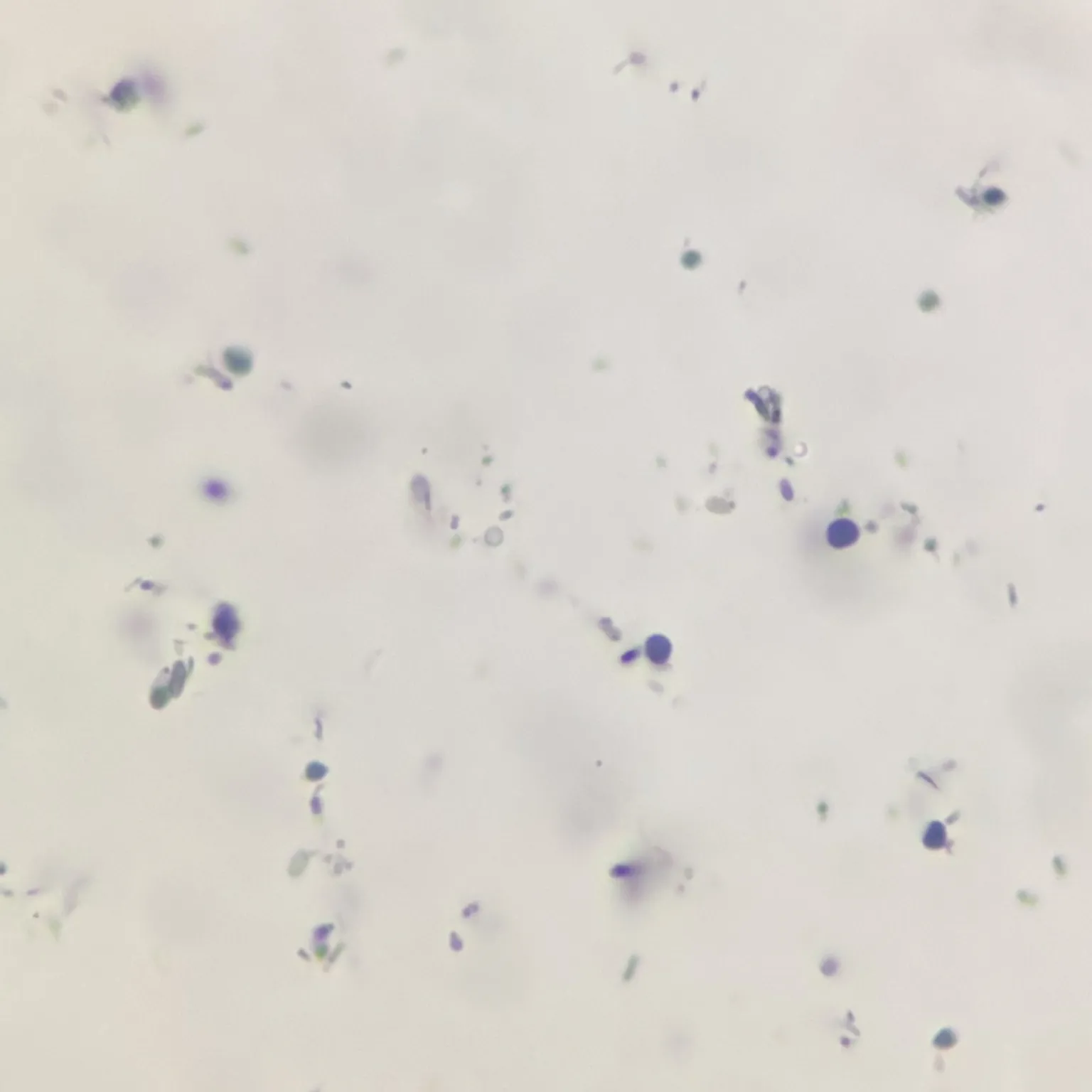 Giardia lamblia Cyst