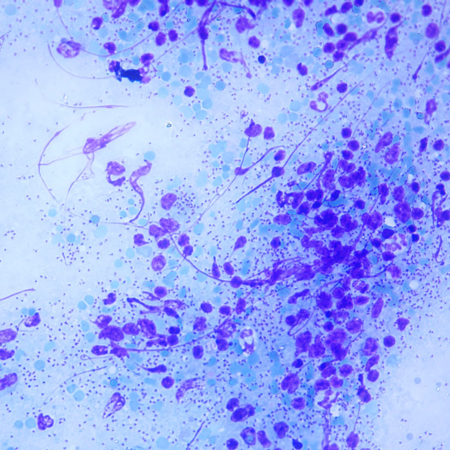 Leishmania donovani amastigote microscope slide