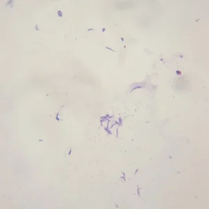 Leishmania donovani promastigotes