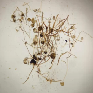 Rhizopus sp. whole mount