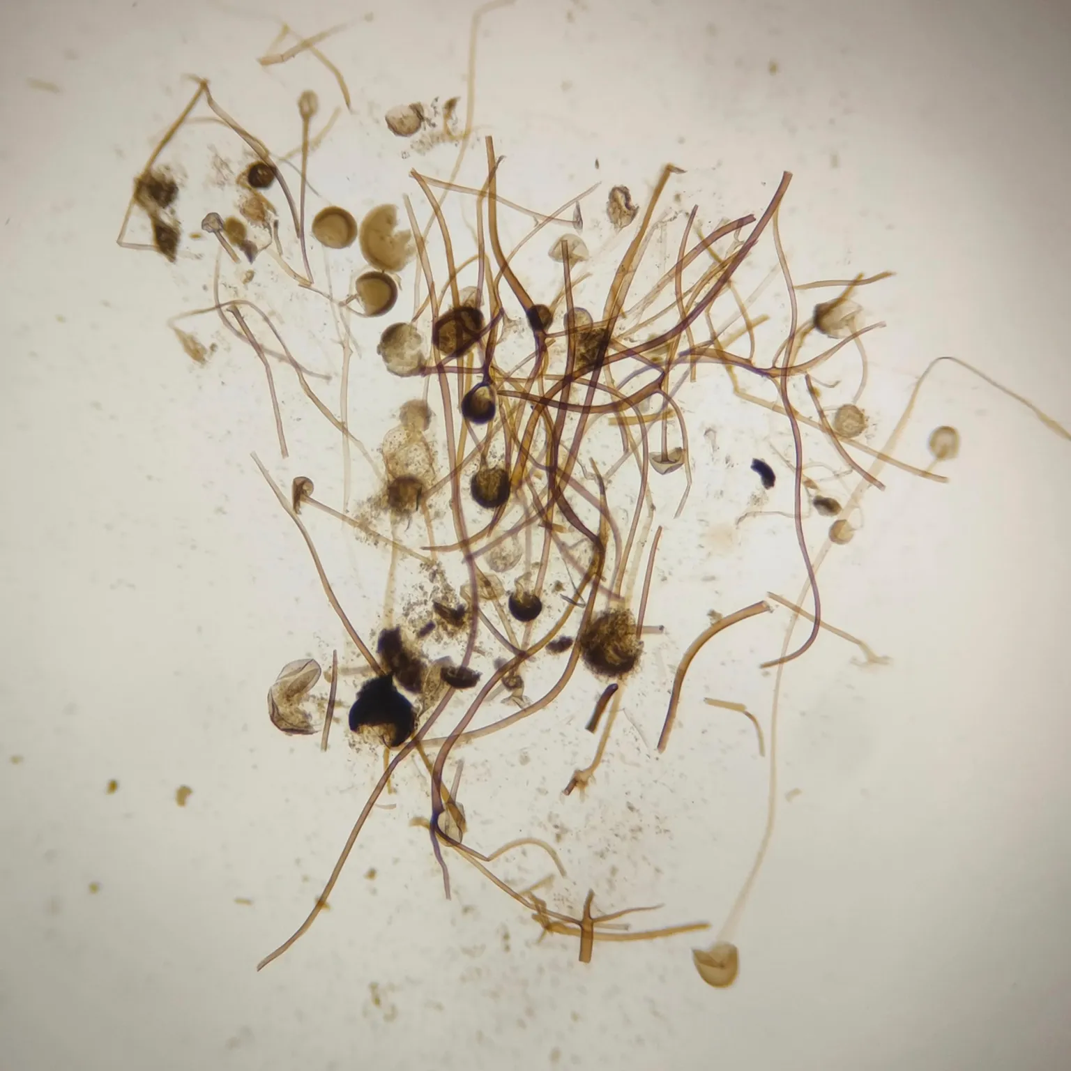 Rhizopus sp. whole mount