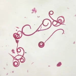 Trichinella Spiralis adult whole mount