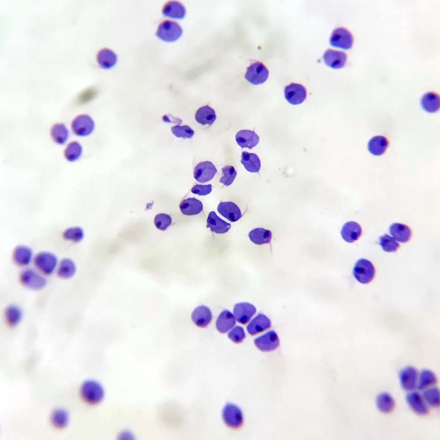 Trichomonas vaginalis Smear, Giemsa Stained