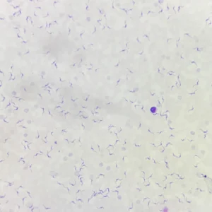Trypanosoma Blood Smear, Giemsa Stained