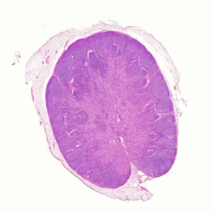 lymph node microscope slide
