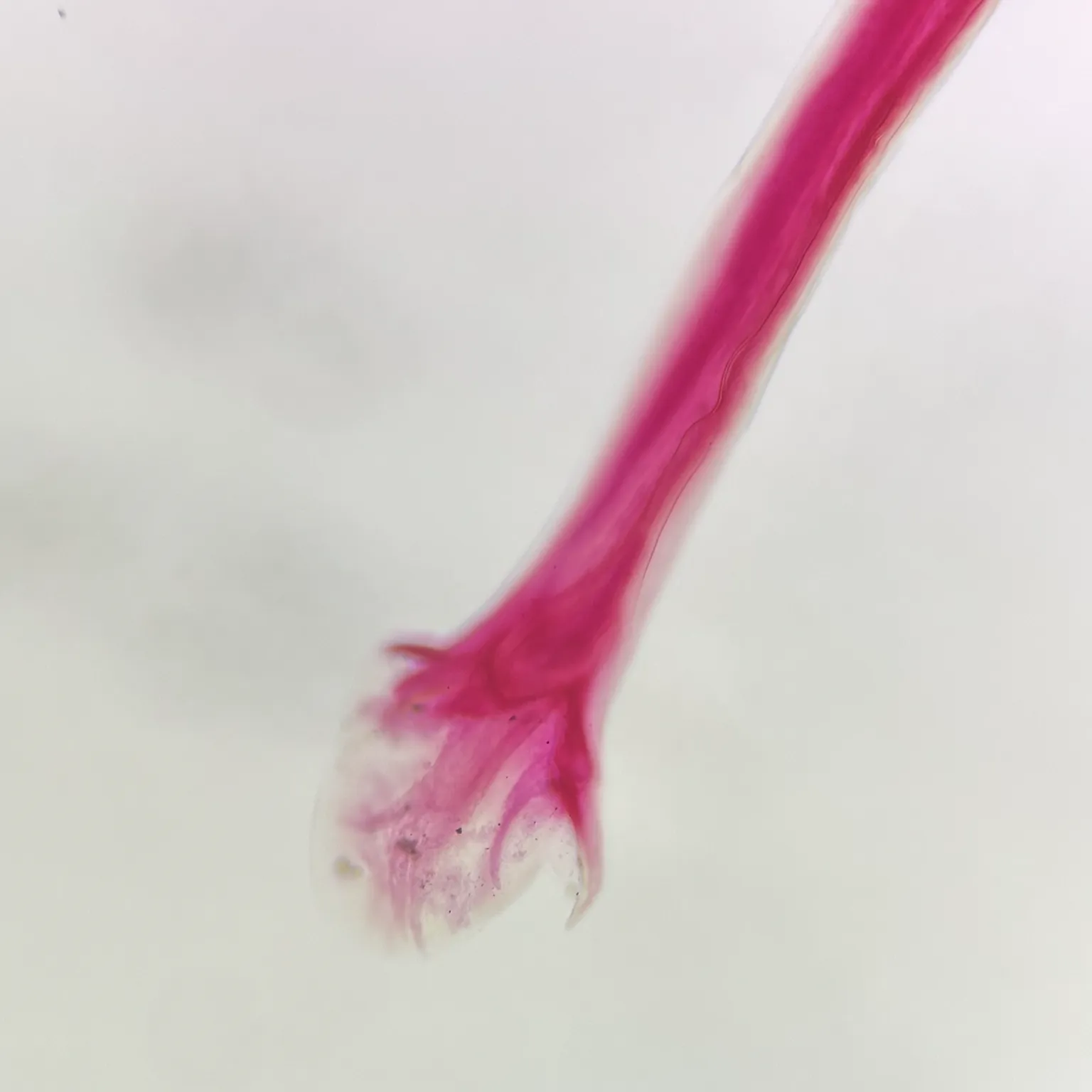Ancylostoma duodenale male microscopeslide