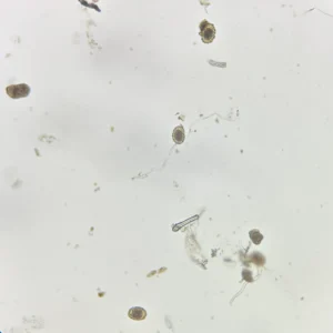 Ascaris lumbricoides Fertilized Ova Microscope Slide