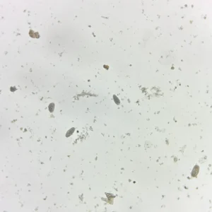 Ascaris lumbricoides unfertilized ova