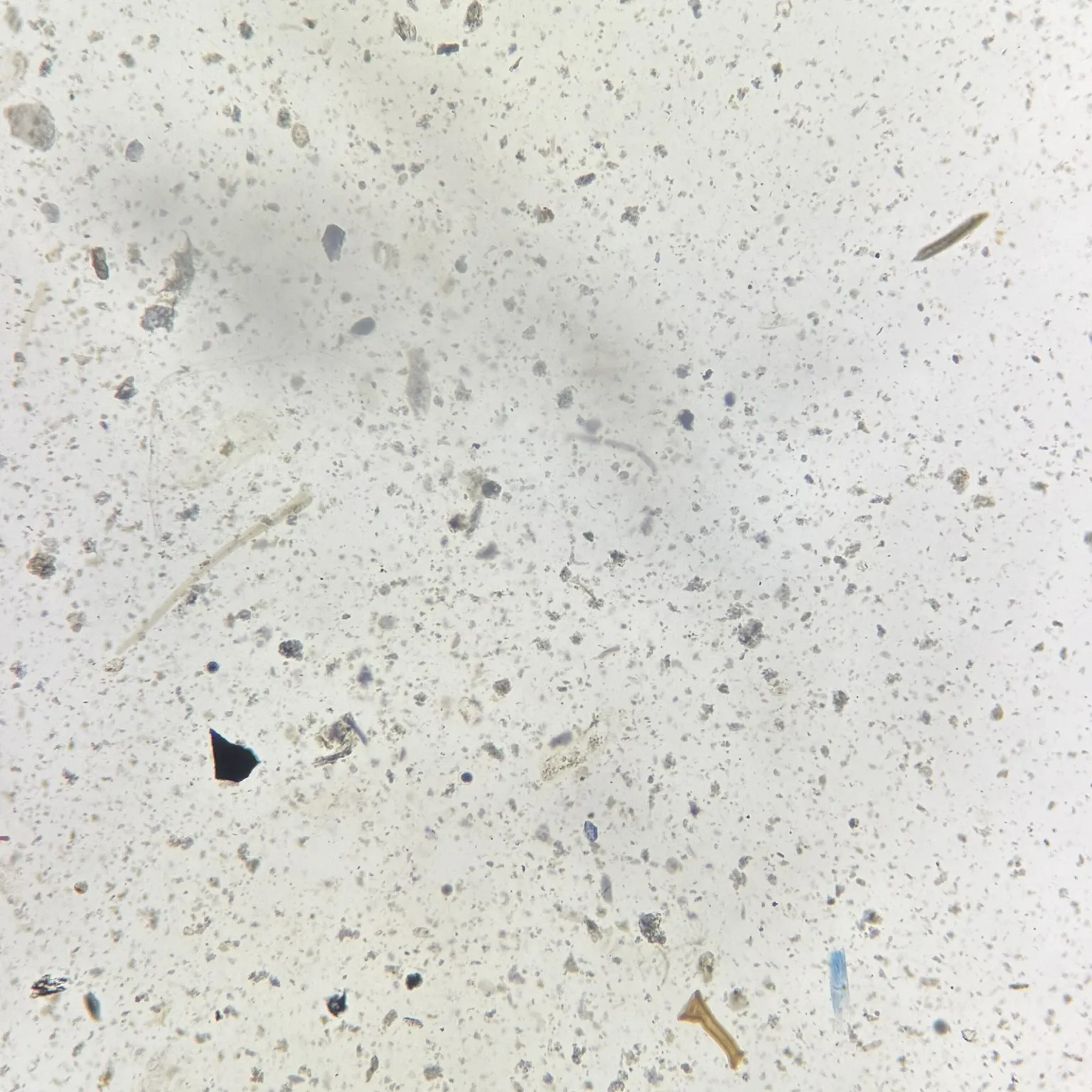 Entamoeba coli cysts 10X