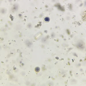 Entamoeba coli cysts 40X