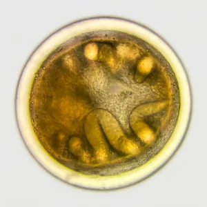 Paragonimus westermani Metacercaria