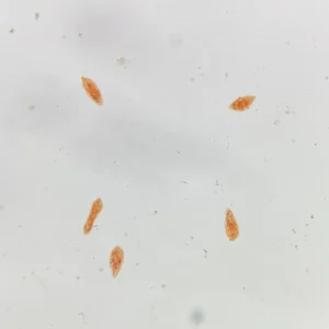 Schistosoma japonicum Miracidium Microscope Slides