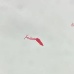 Schistosoma japonicum cercaria