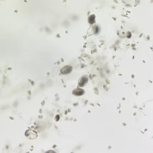 Schistosoma japonicum ova