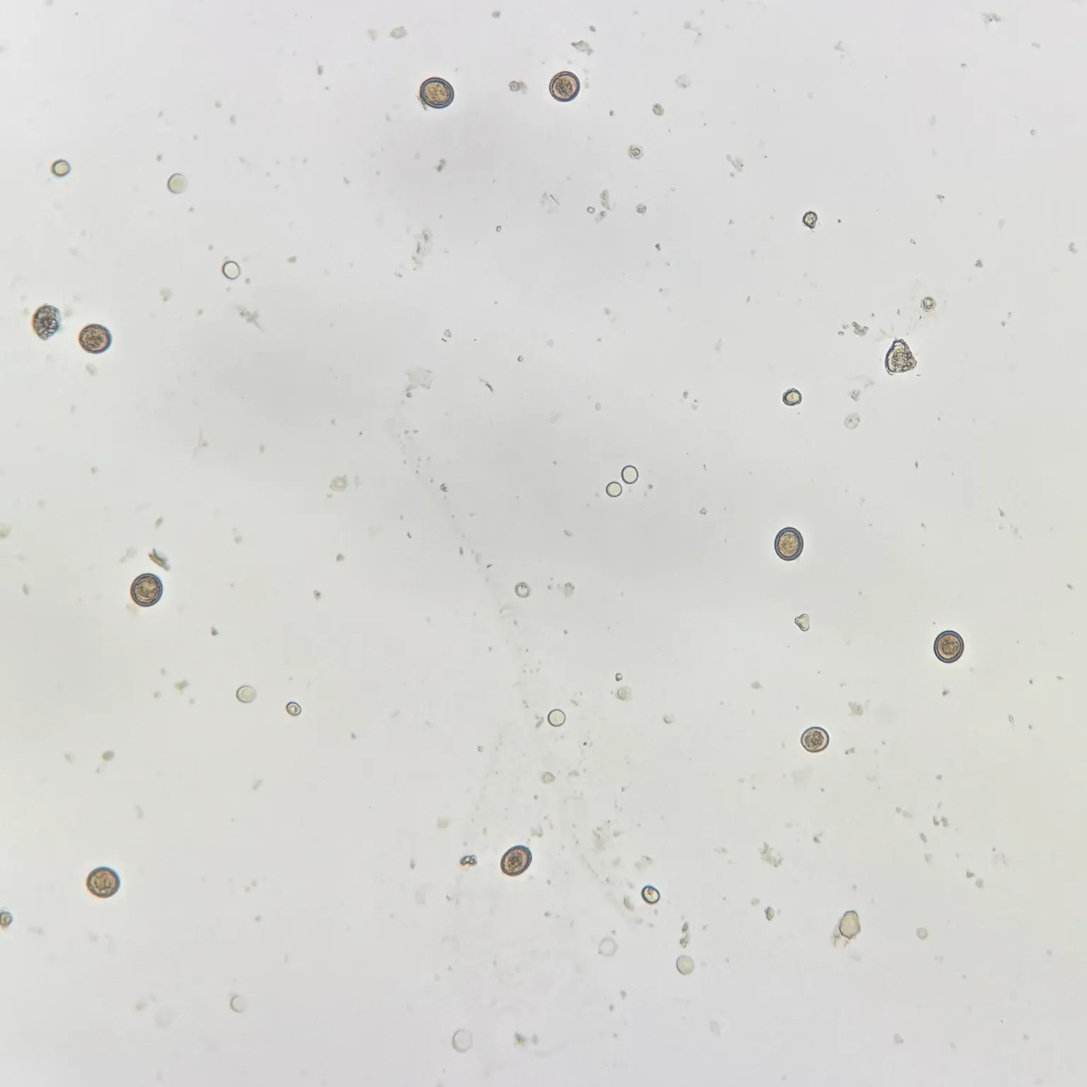 Taenia saginata Ova Microscope Slide