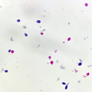 Vorticella microscope slide, ciliate morphology