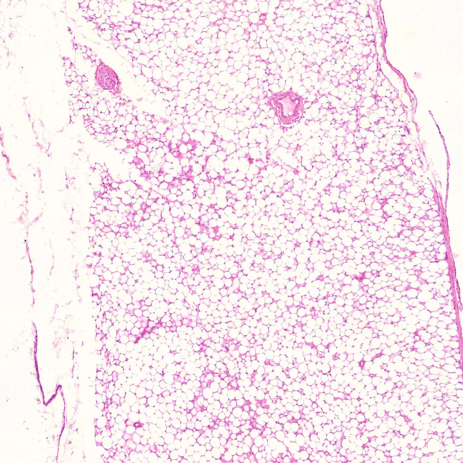 Adipose Tissue Prepared Microscope Slide