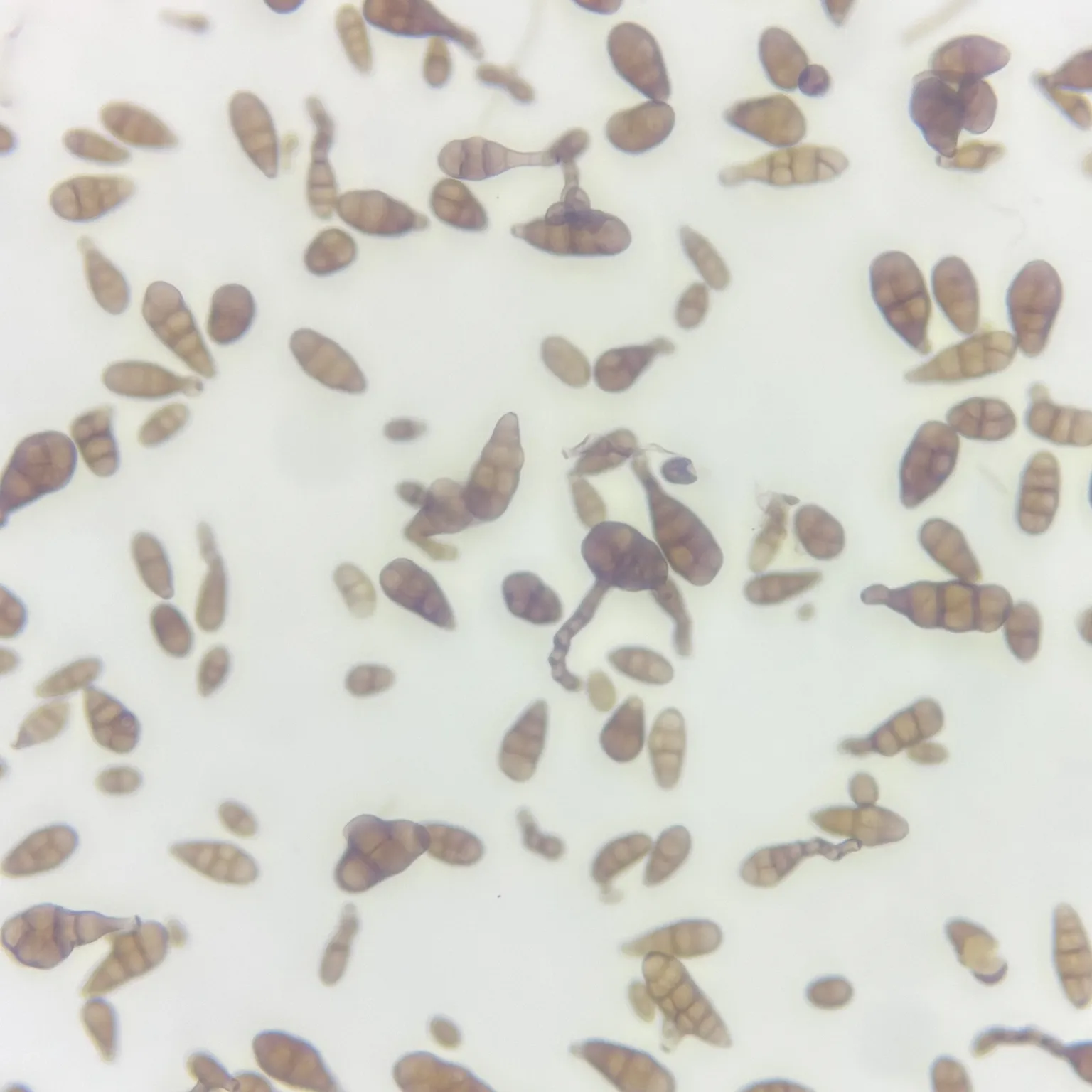 Alternaria conidia whole mount