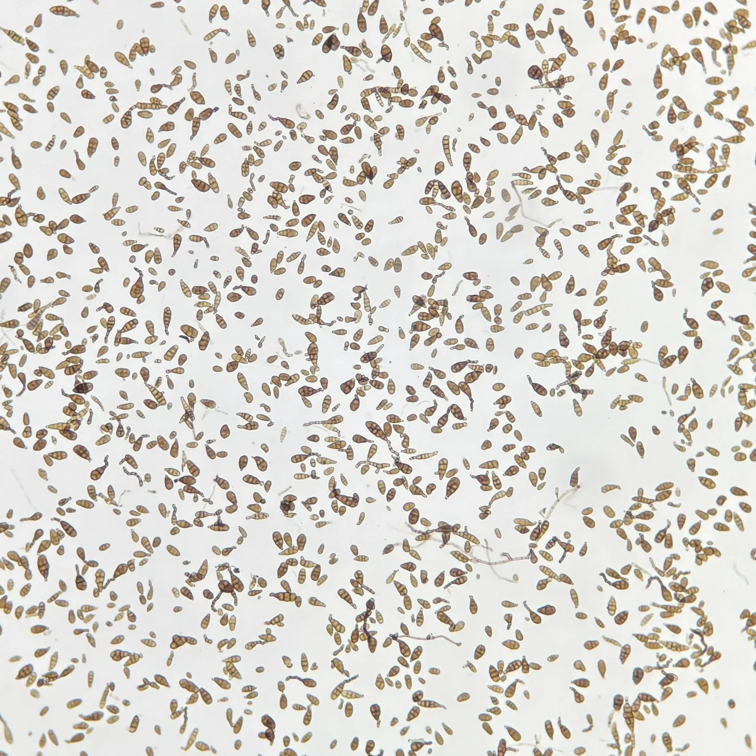 Alternaria prepared microscope slide