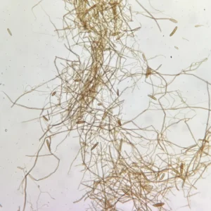 Bipolaris Helminthosporium