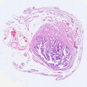 Fallopian tube prepared microscope slide